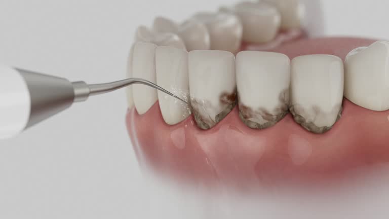 Reliable Tooth Extraction contractor in Grant Parish County, LA by Dentist Open Now